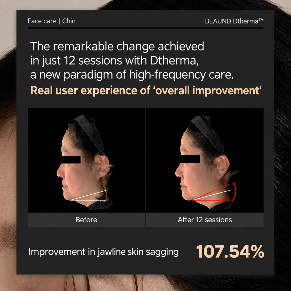 Beaund D-therma